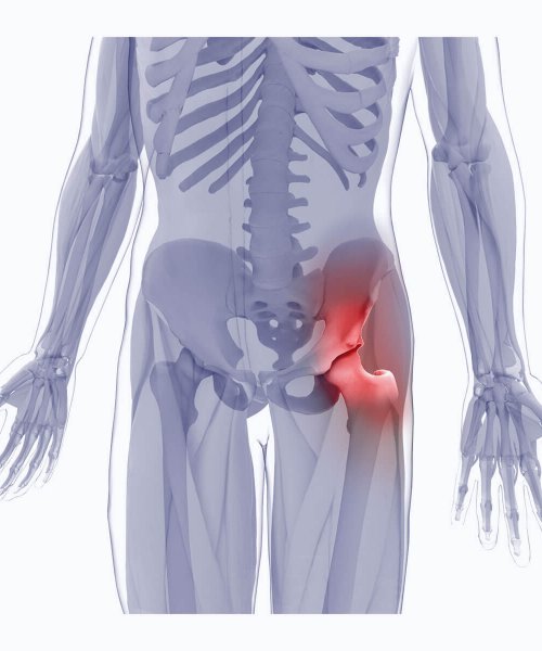 Treatment Hip injury